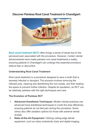 Best Root Canal Treatment in Chandigarh