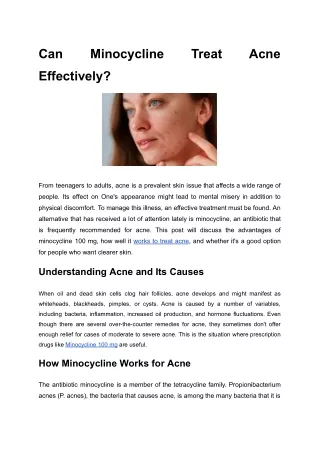 pdf Can Minocycline Treat Acne Effectively (1)