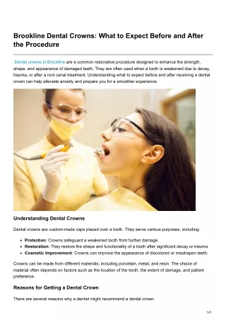 Brookline Dental Crowns What to Expect Before and After the Procedure