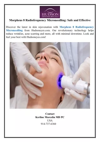 Morpheus 8 Radiofrequency Microneedling: Safe and Effective