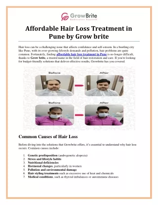 Affordable Hair Loss Treatment in Pune for Effective Results