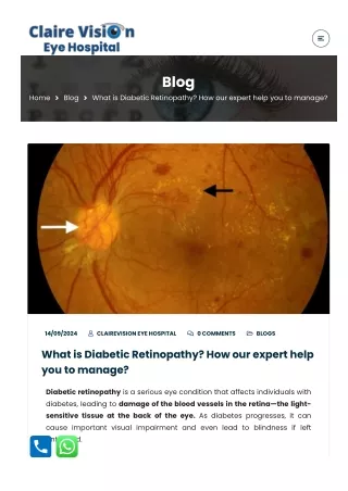 What is Diabetic Retinopathy How our expert help you to manage