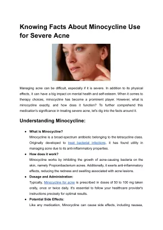Knowing Facts About Minocycline Use for Severe Acne
