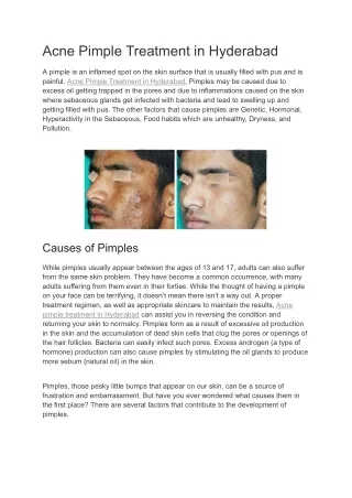 Acne Pimple Treatment in Hyderabad  | Neoskin Clinic