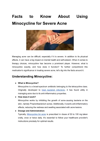 Facts to Know About Using Minocycline for Severe Acne