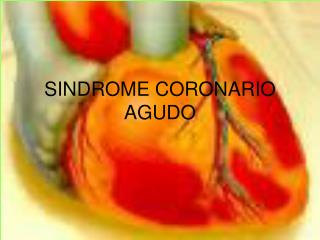 SINDROME CORONARIO AGUDO