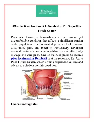 Effective Piles Treatment in Dombivli at Dr. Garje Piles Fistula Center