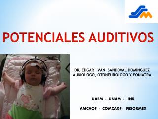 POTENCIALES AUDITIVOS