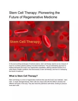 Stem Cell Therapy in Los Angeles