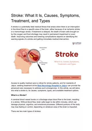 Stroke_ What It Is, Causes, Symptoms, Treatment, and Types