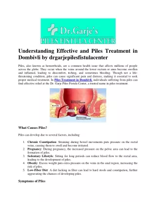 Understanding Effective and Piles Treatment in Dombivli by drgarjepilesfistulace