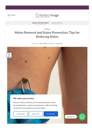 Moles Removal and Stains Prevention Tips for Reducing Stains