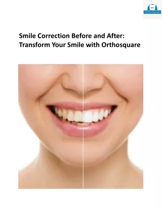 Smile Correction at Orthosquare: Expert Smile Designers