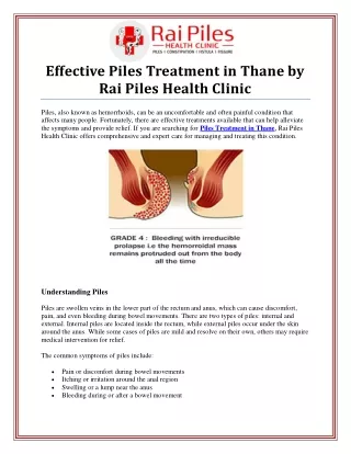 Expert Piles Treatment in Thane at Rai Piles Health Clinic