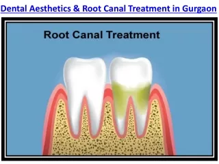 Best Root Canal Treatment in Gurgaon, RCT In India