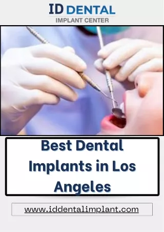 Best Dental Implants in Los Angeles