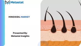 Minoxidil Market Size, Share, Growth, Trends and Forecast