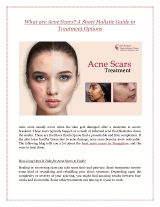 What are Acne Scars? A Short Holistic Guide to Treatment Options