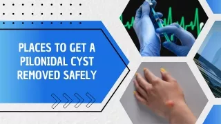 Places to Get a Pilonidal Cyst Removed Safely