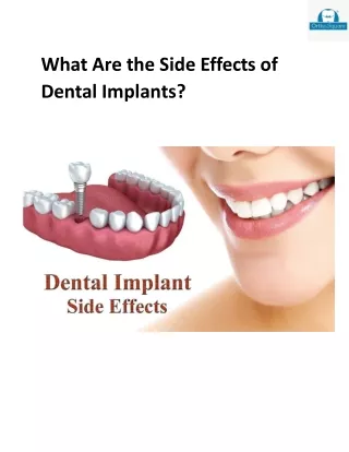 What Are the Side Effects of Dental Implants