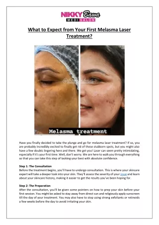 What to Expect from First Melasma Laser Treatment