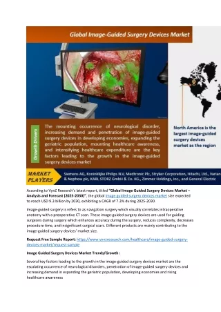 Image Guided Surgery Devices Market Emerging Trends, Global Scope 2030