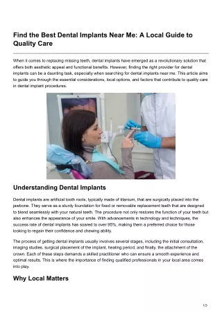 Find the Best Dental Implants Near Me A Local Guide to Quality Care