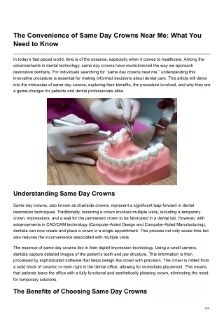 The Convenience of Same Day Crowns Near Me What You Need to Know