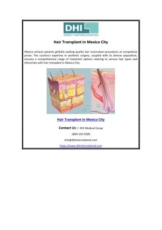 Hair Transplant in Mexico City