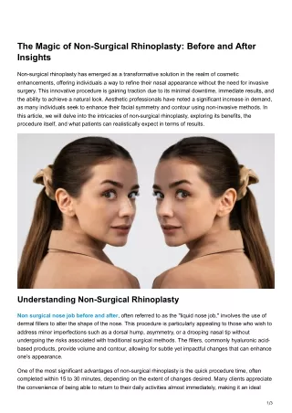 The Magic of Non-Surgical Rhinoplasty Before and After Insights