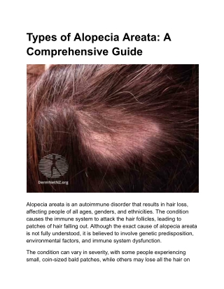 Types of Alopecia Areata: A Comprehensive Guide