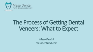 The Process of Getting Dental Veneers: What to Expect
