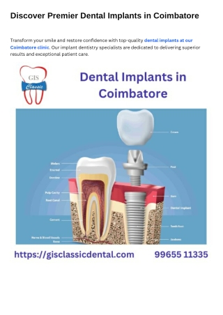 Dental Implants in Coimbatore  Implant Dentistry Coimbatore