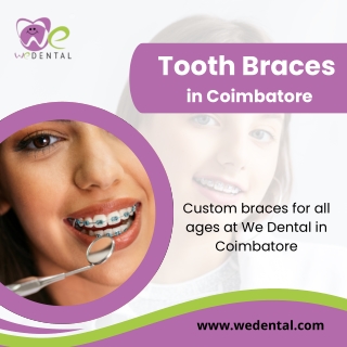 Teeth Braces in Coimbatore