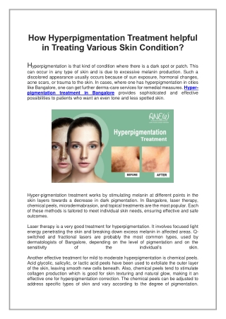 How Hyperpigmentation Treatment helpful in Treating Various Skin Condition