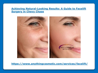 A Guide to Facelift Surgery in Chevy Chase