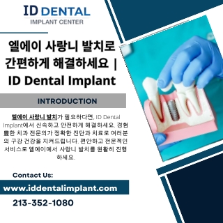 엘에이 사랑니 발치로 간편하게 해결하세요  ID Dental Implant