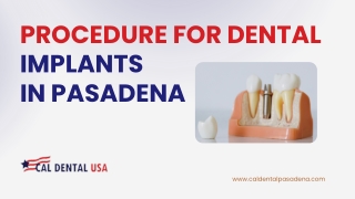 Procedure for dental implants  in Pasadena