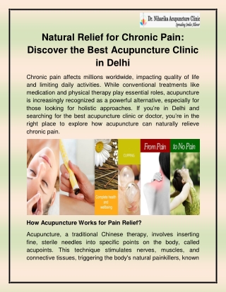 Best Acupuncture doctor in Delhi