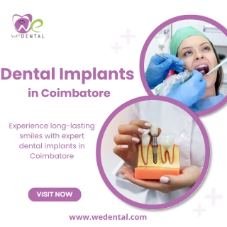 Dental Implants in Coimbatore