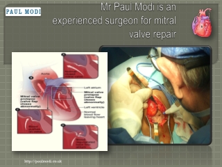 mitral valve