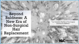 Beyond Baldness A New Era of Non-Surgical Hair Replacement