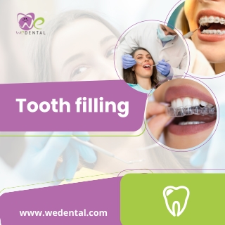 Tooth Filling at We Dental