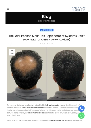 The-Real Reason Most Hair Replacement Systems Don’t Look Natural (And-How to Avoid It)