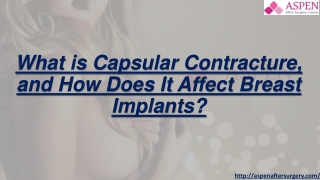 What is Capsular Contracture and How Does It Affect Breast Implants