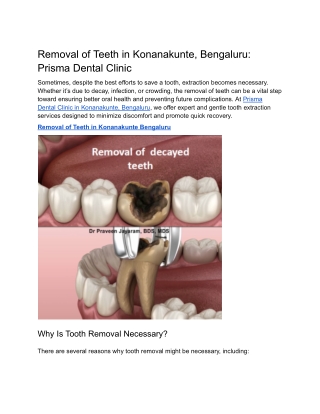 Removal of Teeth in Konanakunte, Bengaluru Prisma Dental Clinic