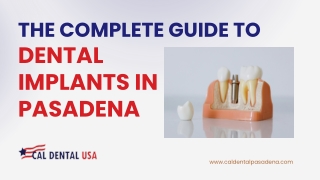 The Complete Guide to Dental Implants in Pasadena