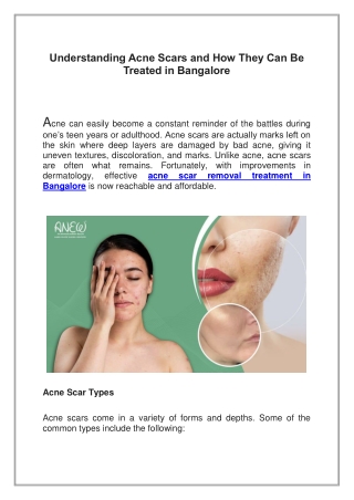 Understanding Acne Scars and How They Can Be Treated in Bangalore