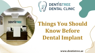 Things You Should Know Before Dental Implant