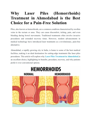 Laser Piles (Hemorrhoids) Treatment in Ahmedabad